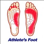 Athlete'sFeet
